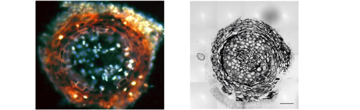 Root cross sections with ectomycorrhiza as transmitted light and fluorescence image, © E. Kothe