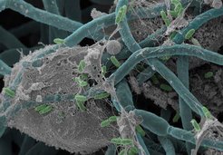 Interaction between bacteria (Proteus mirabilis) and yeast fungi (Candida albicans) in the intestine. Source: Sandor Nietzsche, Susanne Linde/EMZ Jena; photo edited by: Mario Kapitan